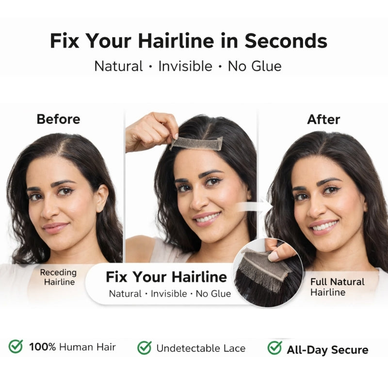 ❤️❤️ Instantly Fix Your Hairline — No One Will Ever Know